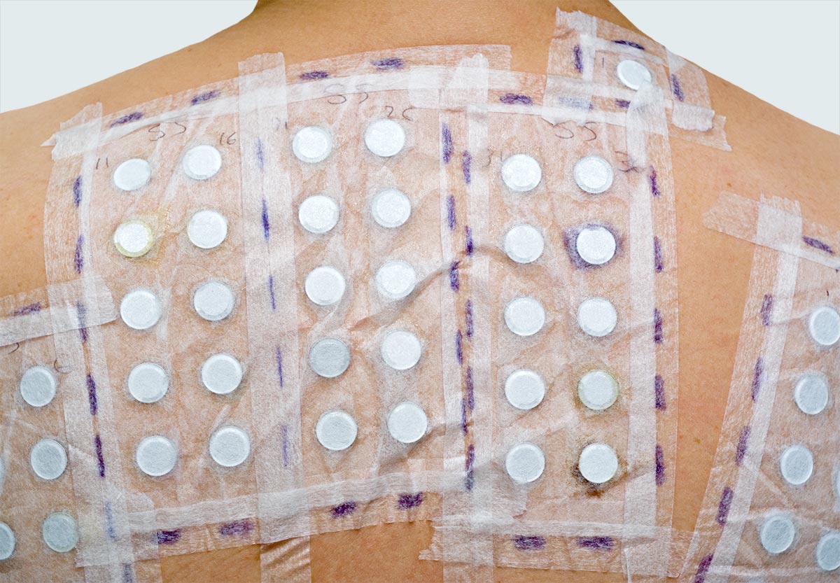 Patch Testing is available at Pure Dermatology & Aesthetics in Hoover, AL