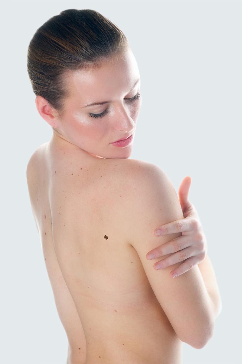 Skin Cancer treatment is available at Pure Dermatology & Aesthetics in Hoover, AL